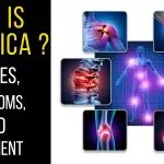 Sciatica Pain: Causes, Symptoms & Advanced Treatment Options